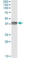 Anti-C4BPB Antibody Pair