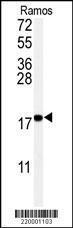 Anti-UBE2I Mouse Monoclonal Antibody (Biotin) [clone: 10i82]