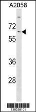 Anti-KLHL14 Rabbit Polyclonal Antibody (HRP (Horseradish Peroxidase))