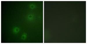 Immunofluorescence analysis of COS7 cells using Anti-Integrin beta1 (phospho Thr789) Antibody. The right hand panel represents a negative control, where the antibody was pre-incubated with the immunising peptide