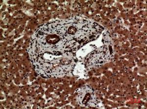 Immunohistochemical analysis of paraffin-embedded human liver using Anti-IL12A Antibody