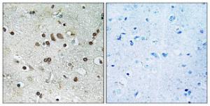 Immunohistochemical analysis of paraffin-embedded human brain tissue using Anti-BTF3L4 Antibody. The right hand panel represents a negative control, where the Antibody was pre-incubated with the immunising peptide