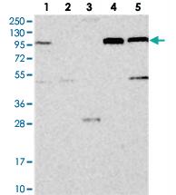 Anti-COPB2 Rabbit Polyclonal Antibody