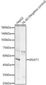 Western blot analysis of various lysates, using Anti-DGAT1 Antibody [ARC58697] (A309345) at 1:1,000 dilution