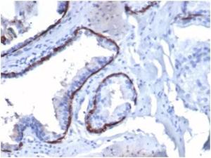 Immunohistochemical analysis of formalin-fixed, paraffin-embedded human prostate tissue using Anti-Cytokeratin 14 Antibody [KRT14/4130] at 2µg/ml