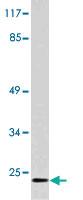 Anti-NMU Rabbit Polyclonal Antibody