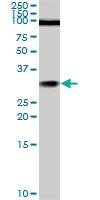 Anti-TGIF2 Mouse Monoclonal Antibody [clone: 5B11]