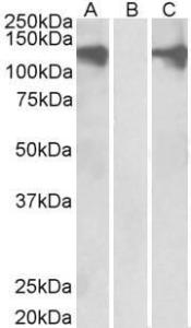 Antibody anti-PUM2 100 µg