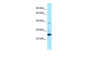 Anti-MOB1B Rabbit Polyclonal Antibody