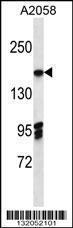 Anti-EIF3A Rabbit Polyclonal Antibody (HRP (Horseradish Peroxidase))