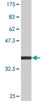 Anti-USP9X Mouse Monoclonal Antibody [clone: 3E12]