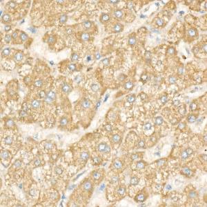 Anti-DGAT1 Rabbit Monoclonal Antibody [clone: ARC58696]