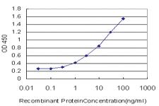 Anti-TGIF2 Mouse Monoclonal Antibody [clone: 5B11]