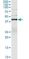 Anti-PTPN2 Polyclonal Antibody Pair