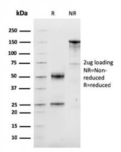 SDS-PAGE analysis of Anti-Cyclin D1 Antibody [CCND1/3548] under non-reduced and reduced conditions; showing intact IgG and intact heavy and light chains, respectively SDS-PAGE analysis confirms the integrity and purity of the antibody