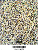 Anti-CORO6 Rabbit Polyclonal Antibody