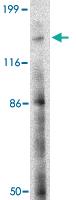 Anti-BAIAP3 Rabbit Polyclonal Antibody