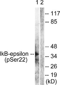 Western blot analysis of lysates from Jurkat cells treated with TNF-a 20ng/ml 30' using Anti-IkappaB-epsilon (phospho Ser22) Antibody The right hand lane represents a negative control, where the antibody is blocked by the immunising peptide