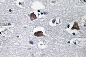 Immunohistochemical analysis of paraffin-embedded human brain tissue using Anti-SDF-1 Antibody