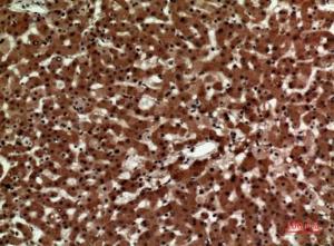 Immunohistochemical analysis of paraffin-embedded human liver using Anti-IL12A Antibody