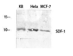 Western blot analysis of various cells using Anti-SDF-1 Antibody