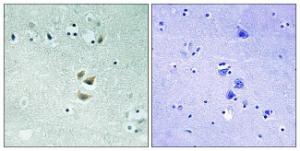 Anti-PKC alpha + beta + gamma Rabbit Polyclonal Antibody