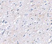 Anti-BAIAP3 Rabbit Polyclonal Antibody