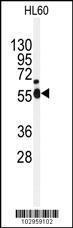 Anti-NEK2 Rabbit Polyclonal Antibody