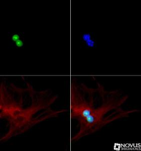 Anti-CDKN2A Rabbit Polyclonal Antibody