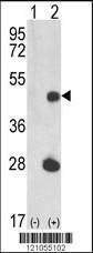 Anti-LUC7-like Rabbit Polyclonal Antibody (AP (Alkaline Phosphatase))