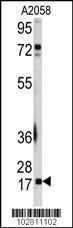 Anti-UBE2I Rabbit Polyclonal Antibody (PE (Phycoerythrin))