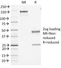 SDS-PAGE analysis of Anti-CD45 Antibody [PTPRC/1461] under non-reduced and reduced conditions; showing intact IgG and intact heavy and light chains, respectively SDS-PAGE analysis confirms the integrity and purity of the antibody