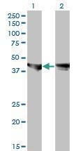 Anti-MAP Kinase 3 Mouse Monoclonal Antibody [clone: 3C9]