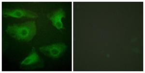 Immunofluorescence analysis of HeLa cells using Anti-IkappaB-epsilon (phospho Ser22) Antibody The right hand panel represents a negative control, where the antibody was pre-incubated with the immunising peptide