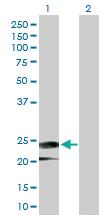 Anti-IFNA14 Rabbit Polyclonal Antibody