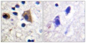 Immunohistochemical analysis of paraffin-embedded human brain tissue using Anti-PIP5K Antibody. The right hand panel represents a negative control, where the antibody was pre-incubated with the immunising peptide