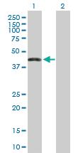 Anti-ZNF302 Mouse Polyclonal Antibody