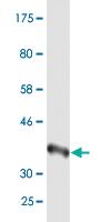 Anti-WRN Mouse Monoclonal Antibody [clone: 2F7]