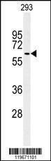 Anti-ATG14 Rabbit Polyclonal Antibody (FITC (Fluorescein Isothiocyanate))