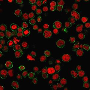 Anti-CD31 antibody