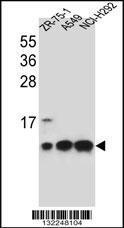 Anti-COX6B1 Rabbit Polyclonal Antibody (APC (Allophycocyanin))