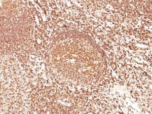 Immunohistochemical analysis of formalin-fixed, paraffin-embedded human tonsil using Anti-CD45 Antibody [F10-89-4]