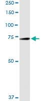 Anti-GAS6 Polyclonal Antibody Pair