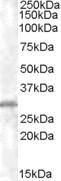 Anti-CHMP5 Antibody (A84077) (x µg/ml) staining of K562 lysate (35 µg protein in RIPA buffer). Primary incubation was 1 hour. Detected by chemiluminescence