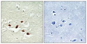 Immunohistochemical analysis of paraffin-embedded human brain using Anti-PDCD4 Antibody 1:100 (4 °C overnight). The right hand panel represents a negative control, where the antibody was pre-incubated with the immunising peptide