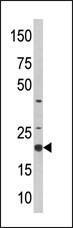 Anti-SKP1 Rabbit Polyclonal Antibody (AP (Alkaline Phosphatase))