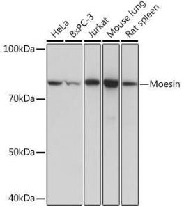 Western blot analysis of extracts of various cell lines, using Anti-Moesin Antibody [ARC1258] (A306371) at 1:1,000 dilution. The secondary antibody was Goat Anti-Rabbit IgG H&L Antibody (HRP) at 1:10,000 dilution.