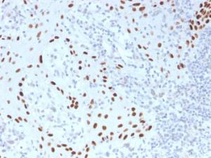 Immunohistochemical analysis of formalin-fixed, paraffin-embedded human skin using Anti-p40 Antibody [TP40/3980R]