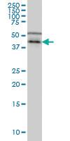 Anti-CSNK1G1 Mouse Monoclonal Antibody [clone: 3D1]