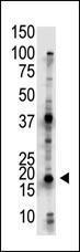 Anti-UBE2G2 Rabbit Polyclonal Antibody (PE (Phycoerythrin))